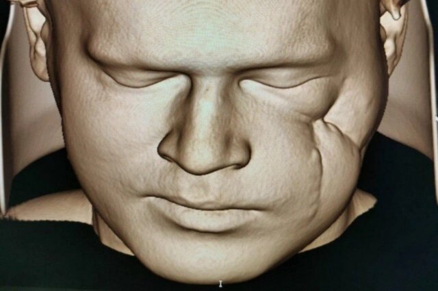    Фото: Минздрав Свердловской области