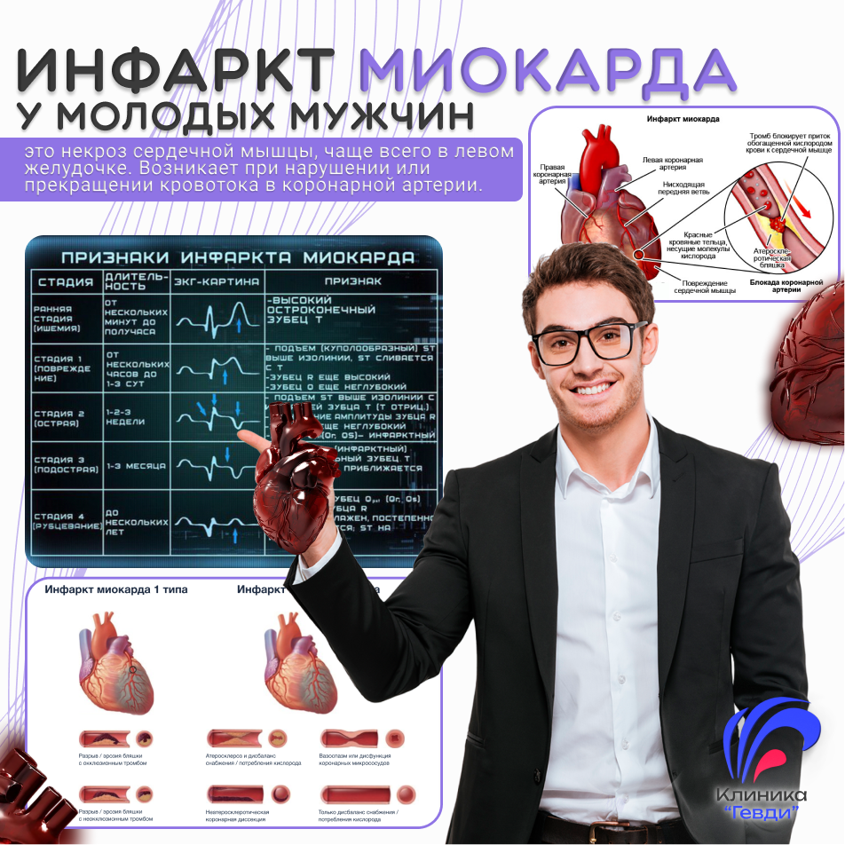 Инфаркт Миокарда у молодых мужчин.