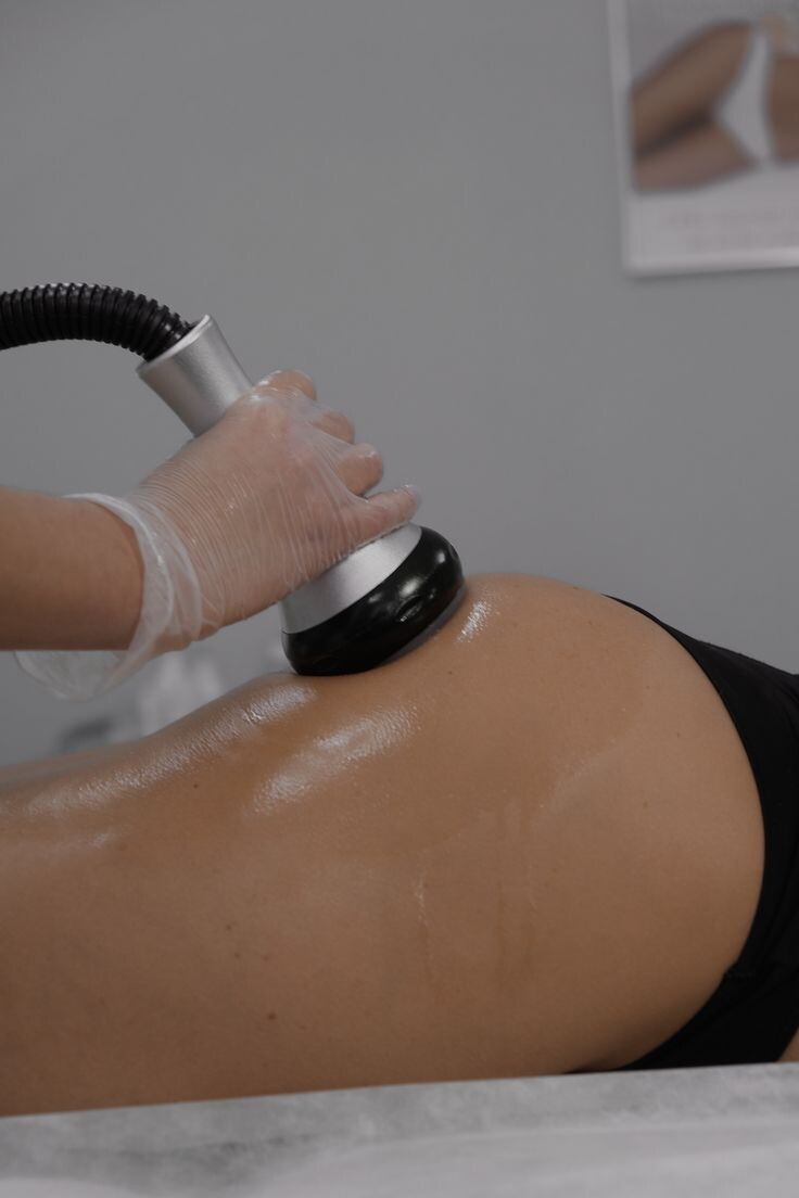 Вакуумный массаж: как избавиться от целлюлита и подтянуть тело без уколов