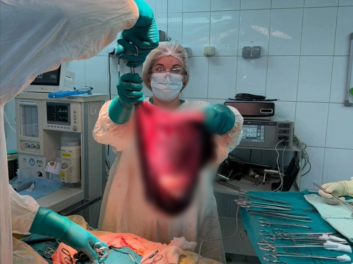     Красноярские хирурги удалили пациентке гигантскую опухоль яичника