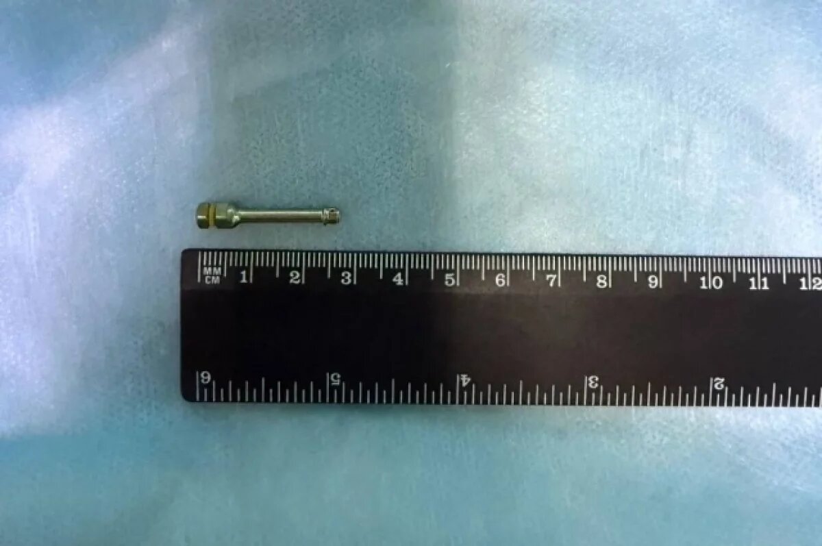    Врачи вытащили трёхсантиметровый болт у кемеровчанина из тонкой кишки