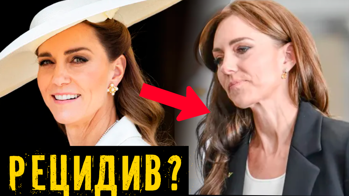 Может ли у Кейт Миддлтон возникнуть рецидив рака? Странности в поведении принцессы: «прислушивается к своему телу»