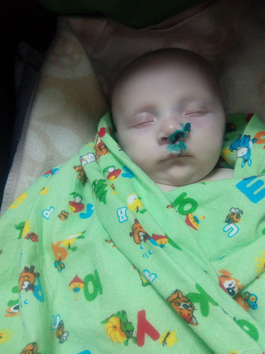 После операции. Спасибо нашему доктору за красоту)