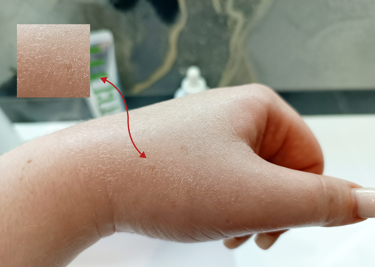 При нанесении крема L.Sanic на влажную кожу образуется мыльная плёнка — состав не впитывается, остаётся на поверхности, блестит и слегка липнет.
Возникает вопрос: как долго подобный слой будет высыхать и насколько это безопасно для кожи?