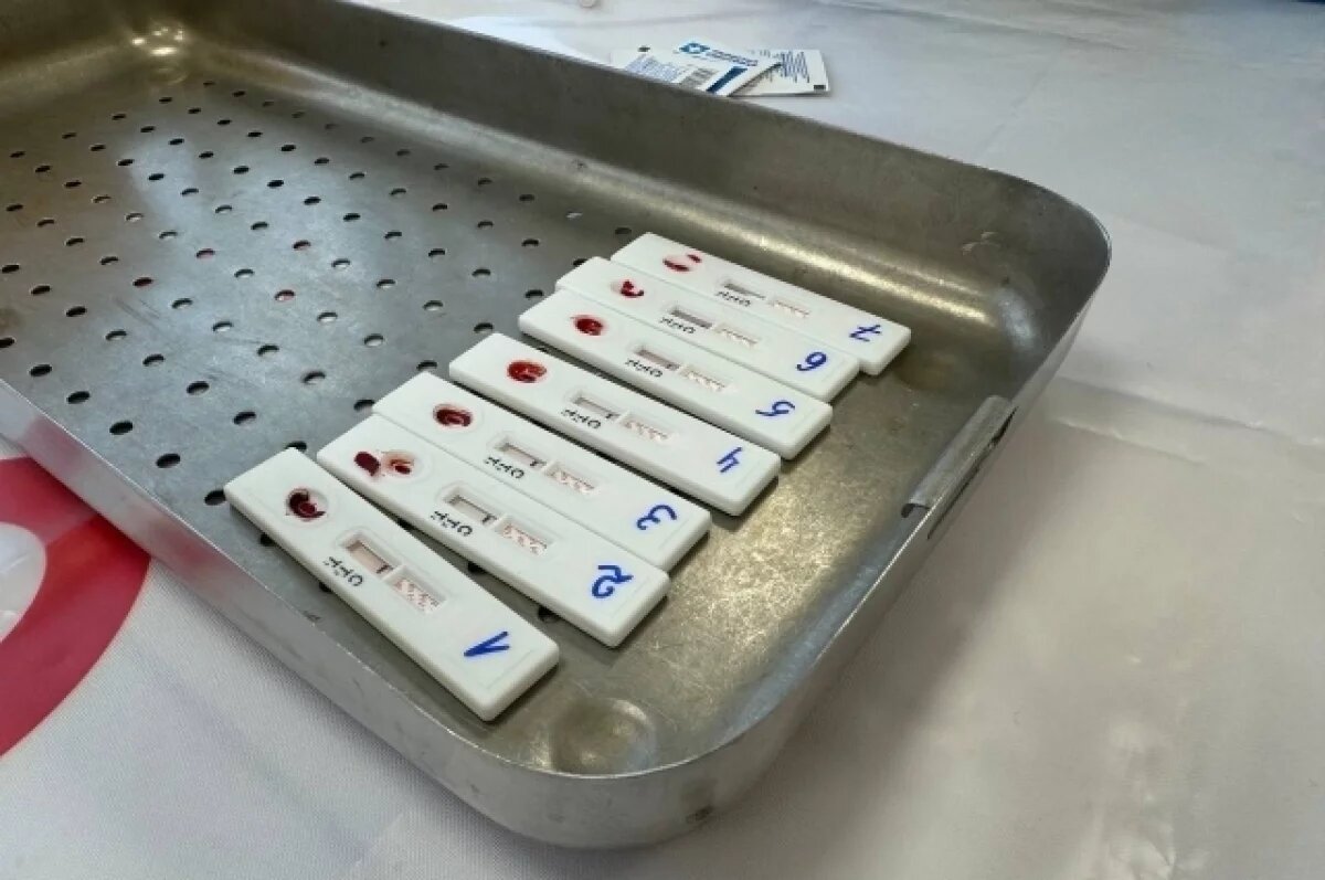    В Ульяновске заработал мобильный пункт тестирования на ВИЧ