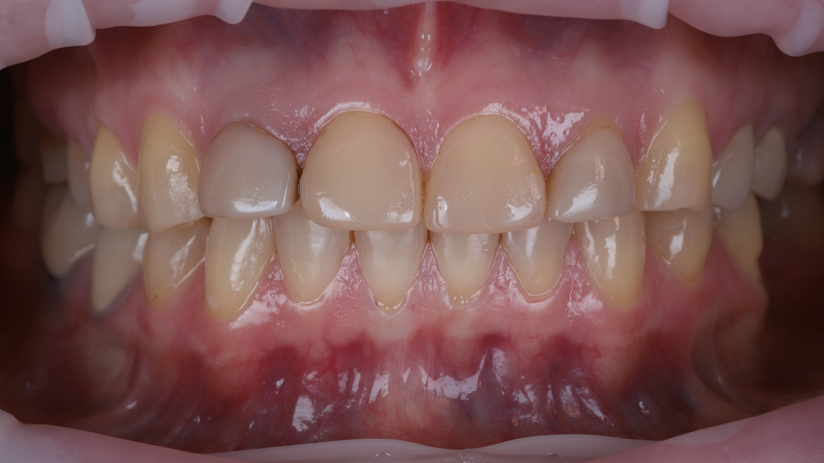 Фотография до лечения 