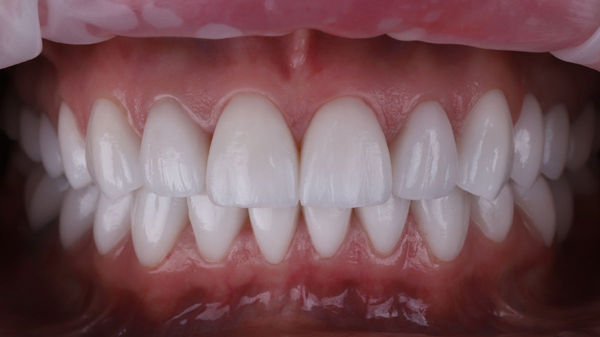 Фотография после лечения 