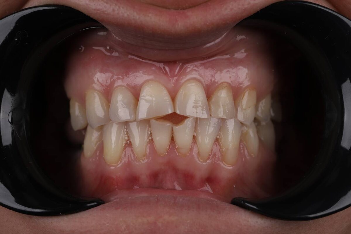 Фотография до лечения