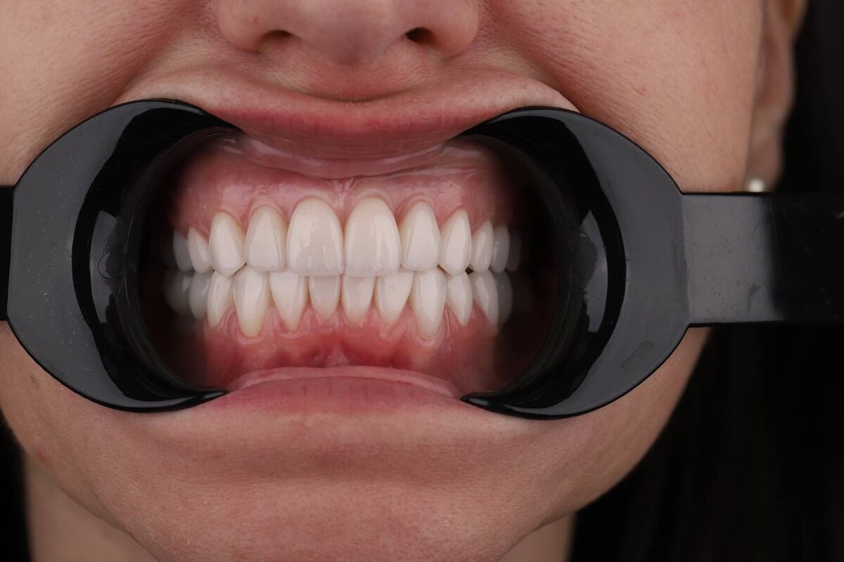 Фотография после лечения 