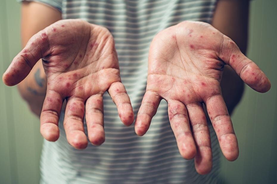    Shutterstock/FOTODOM