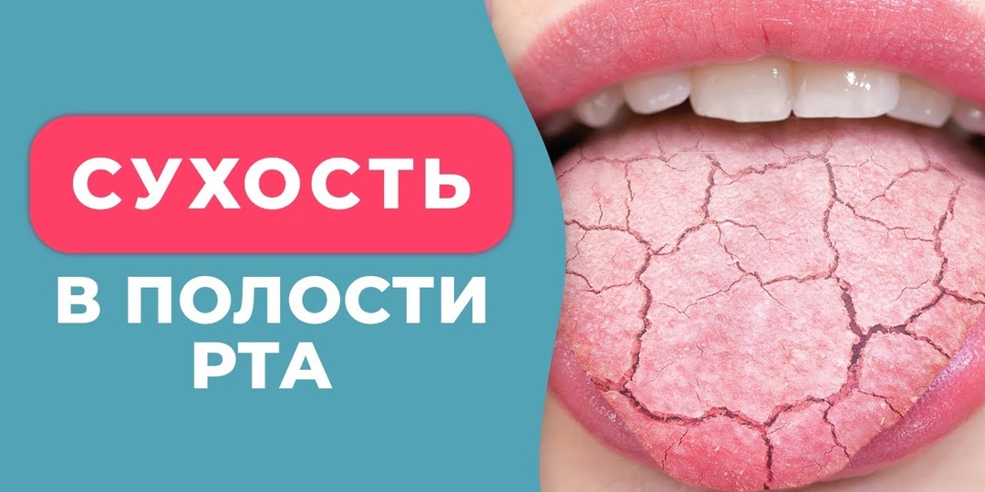 Что говорит сухость во рту по ночам — возможно, это сахарный диабет