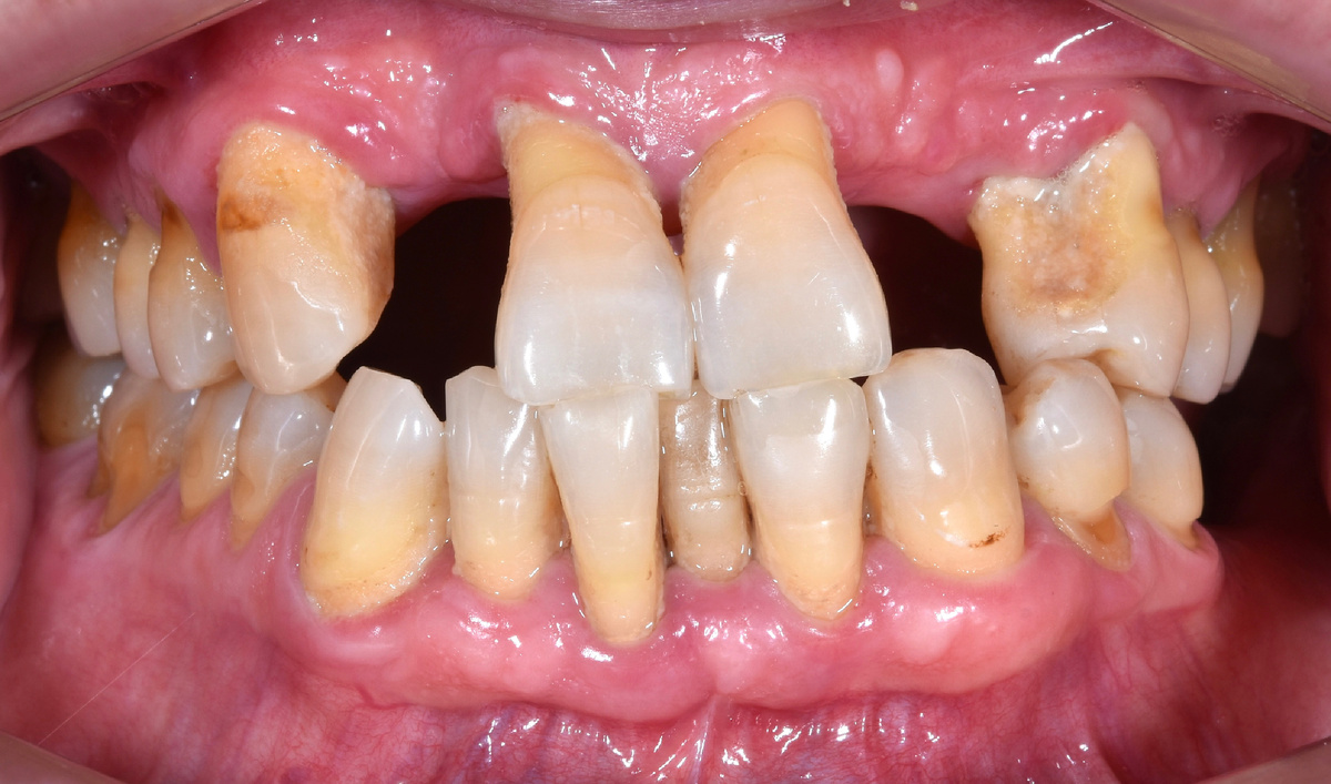 Состояние до "всё на 4"