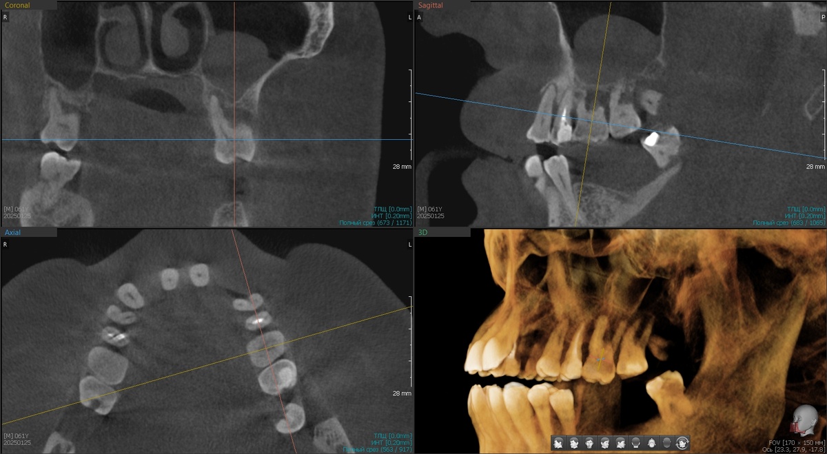 Левая сторона