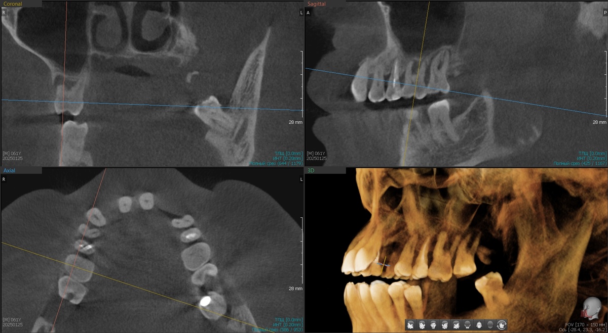 Правая сторона