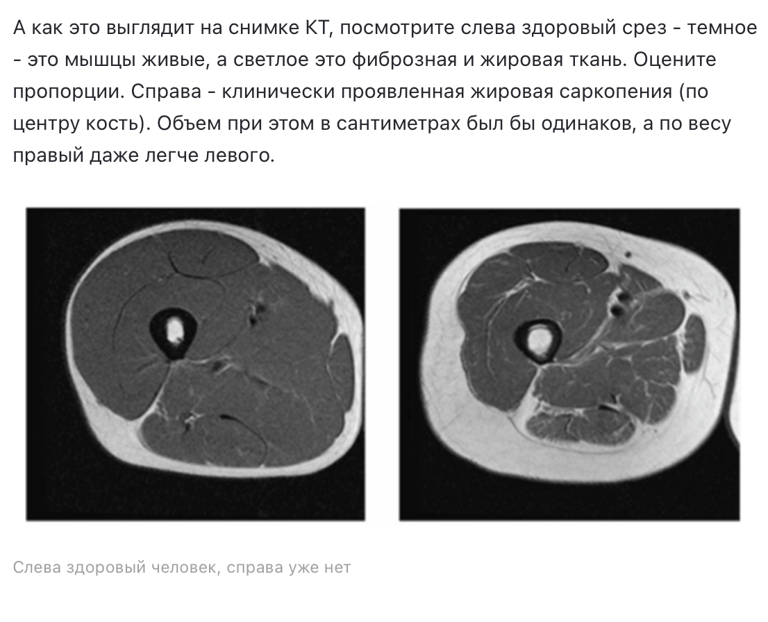 Также прошу братить ваше внимание на толщину темной области - это и есть та плотная часть кости, дающая ей прочность.