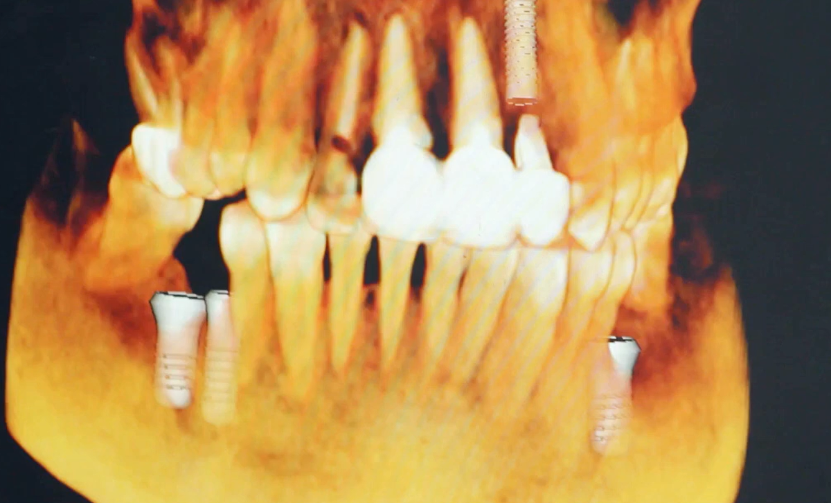 Рентген снимок