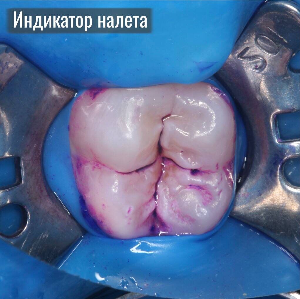 Индикация налета 