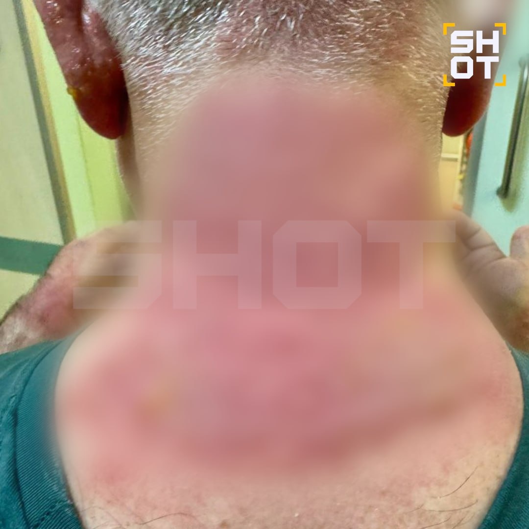 Так сейчас выглядит шея мужчины