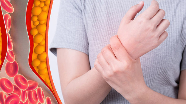 Как менопауза влияет на уровень холестерина — и что с этим делать