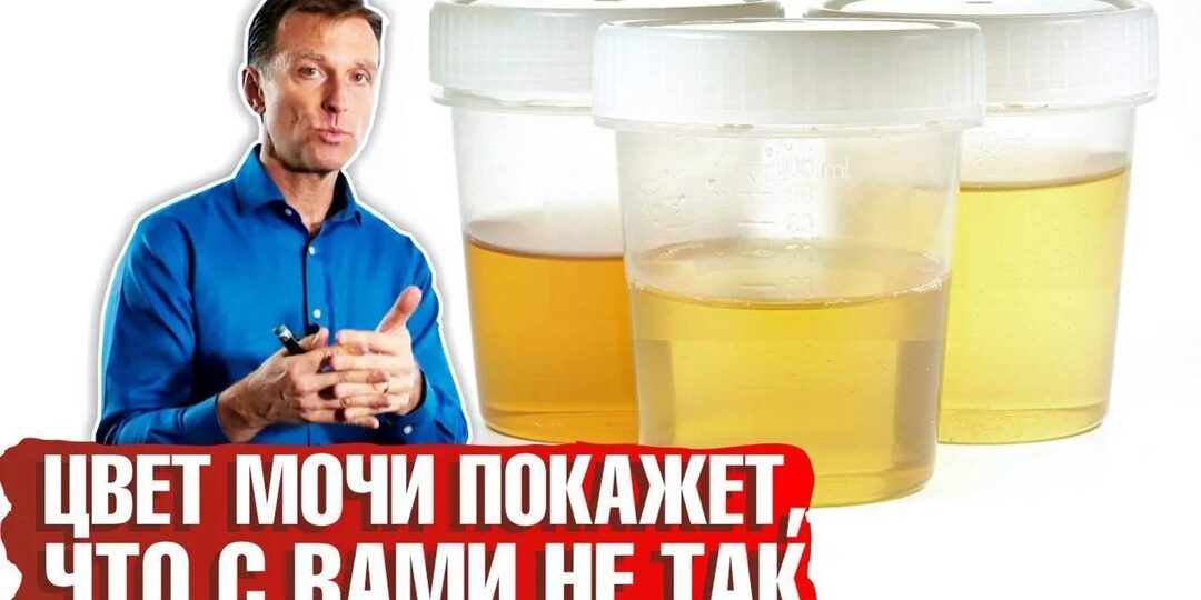 Цвет мочи может рассказать больше, чем вы думаете: Полный гид по сигналам вашего тела