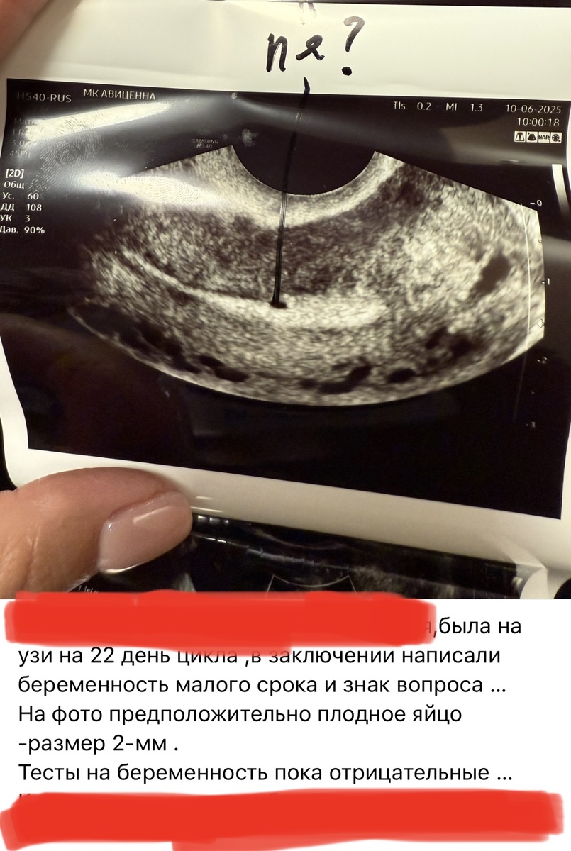 Разберем сегодня этот запрос 