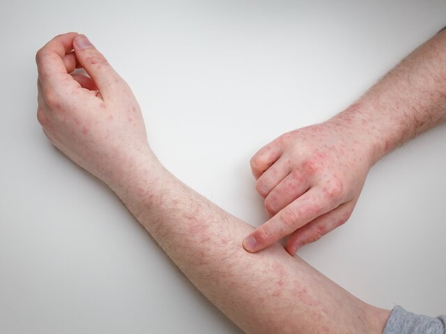    Фото: 123RF/olenaseiryk