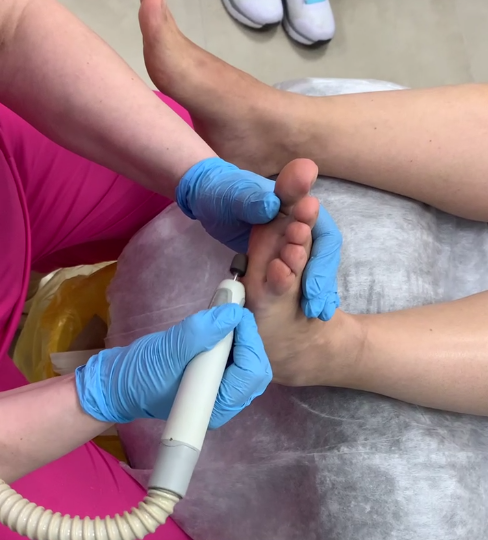 Медицинский педикюр при диабете — почему это важно для здоровья ваших ног?