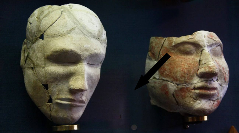    Древние нейрохирургические чудеса: тайна трепанации черепов