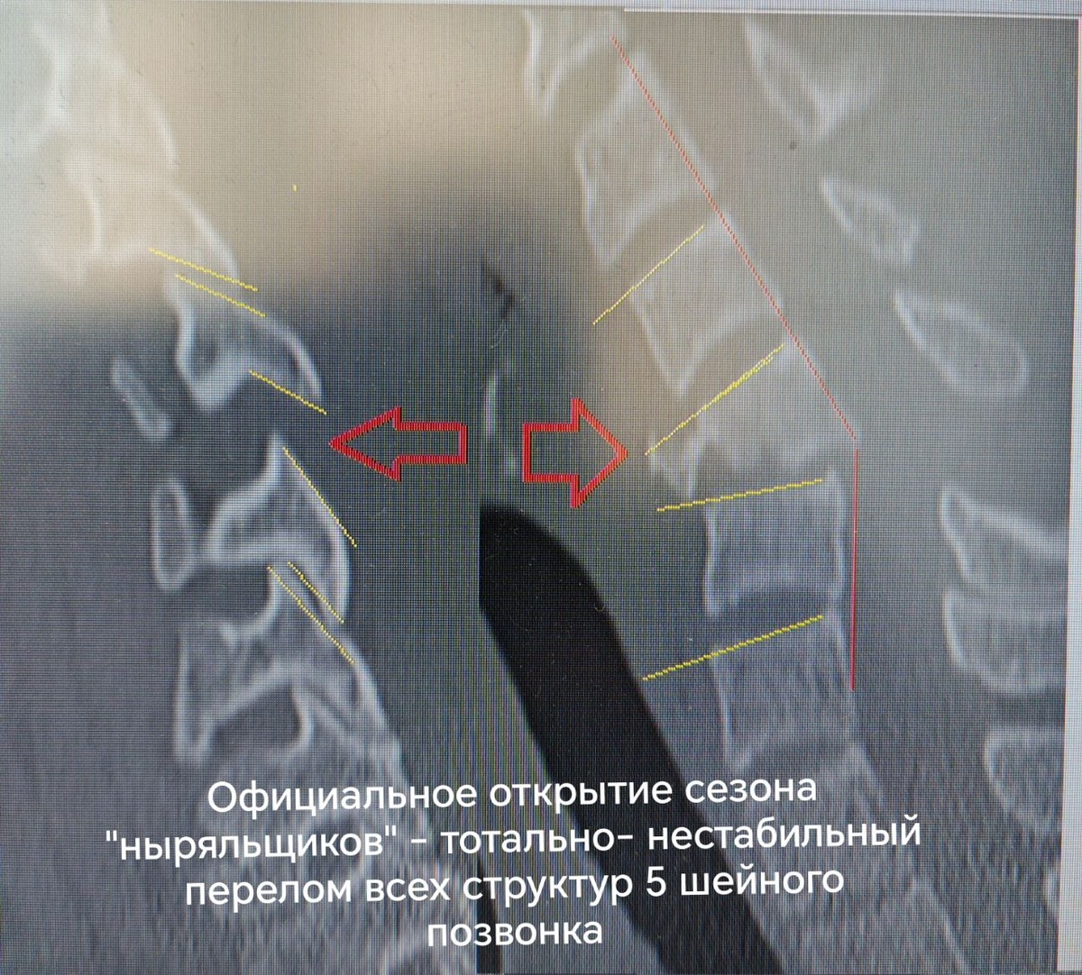   Фото: Красноярская БСМП им. Н.С.Карповича / ВКонтакте