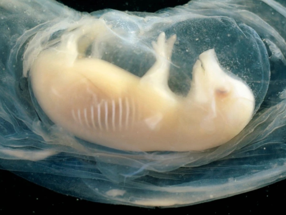    Человеческое сердце впервые вырастили в эмбрионе свиньи