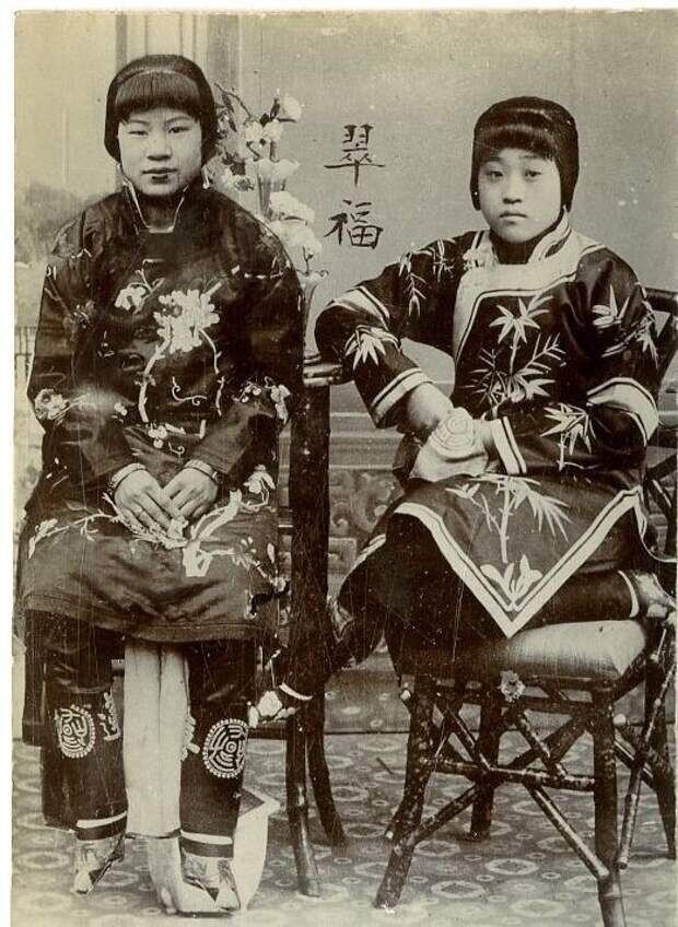 девушки, подвергшиеся традиции бинтования ног