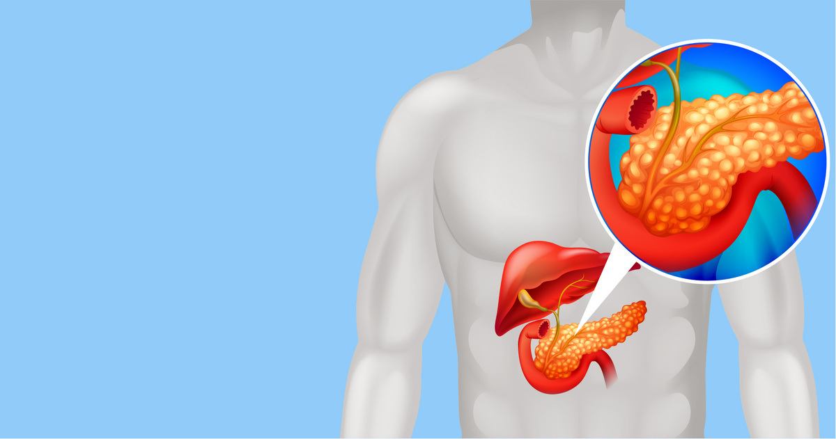 У меня нашли панкреатит, а я думала — просто тяжесть в животе