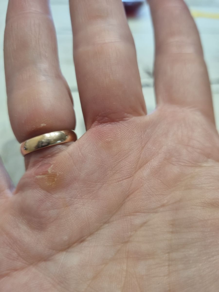 Мозоли просто уххх! Правда?