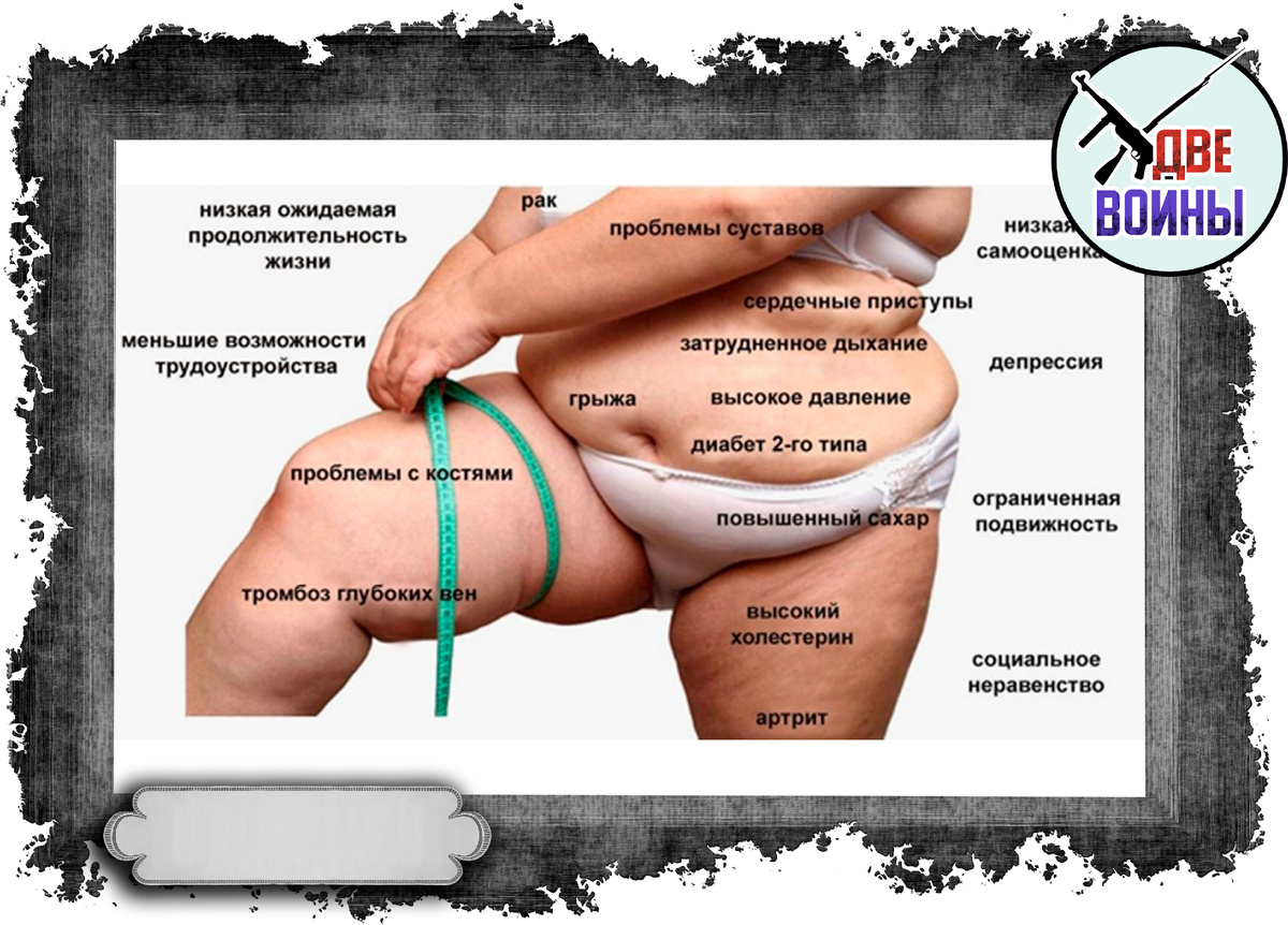 Последствия ожирения