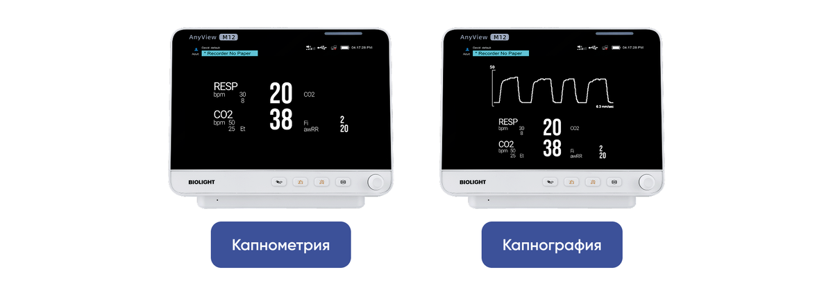 Сравнение результатов капнометрии и капнографии
