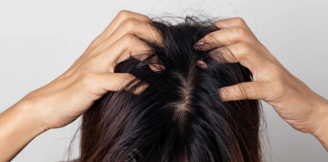 Зуд кожи головы: врач назвала 7 основных причин - это не только перхоть