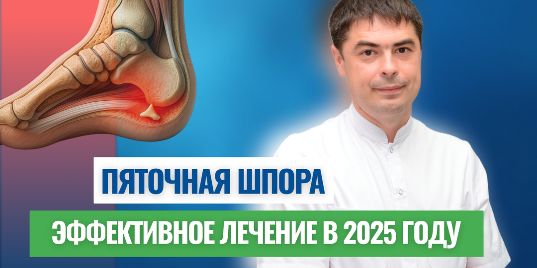 Новые методы лечения пяточной шпоры в 2025 году — опыт врачей из Уфы