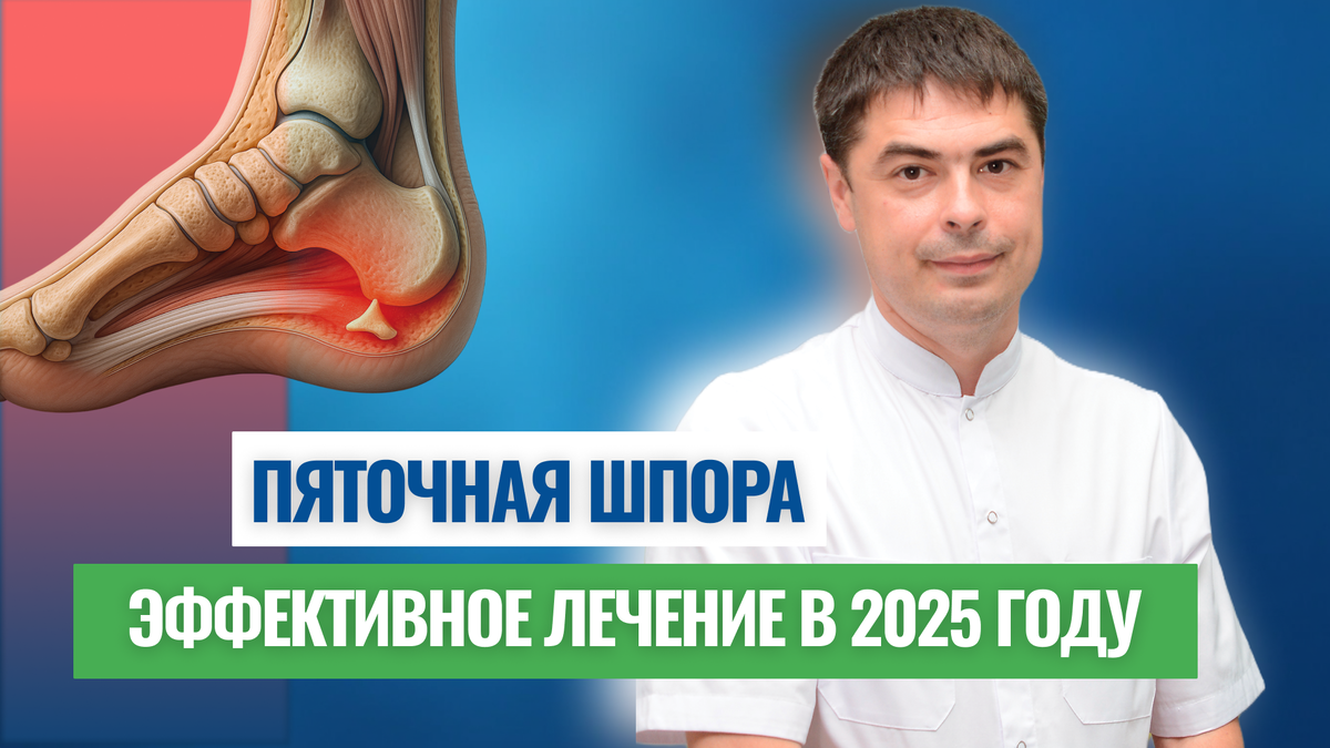 лечение пяточной шпоры в Уфе