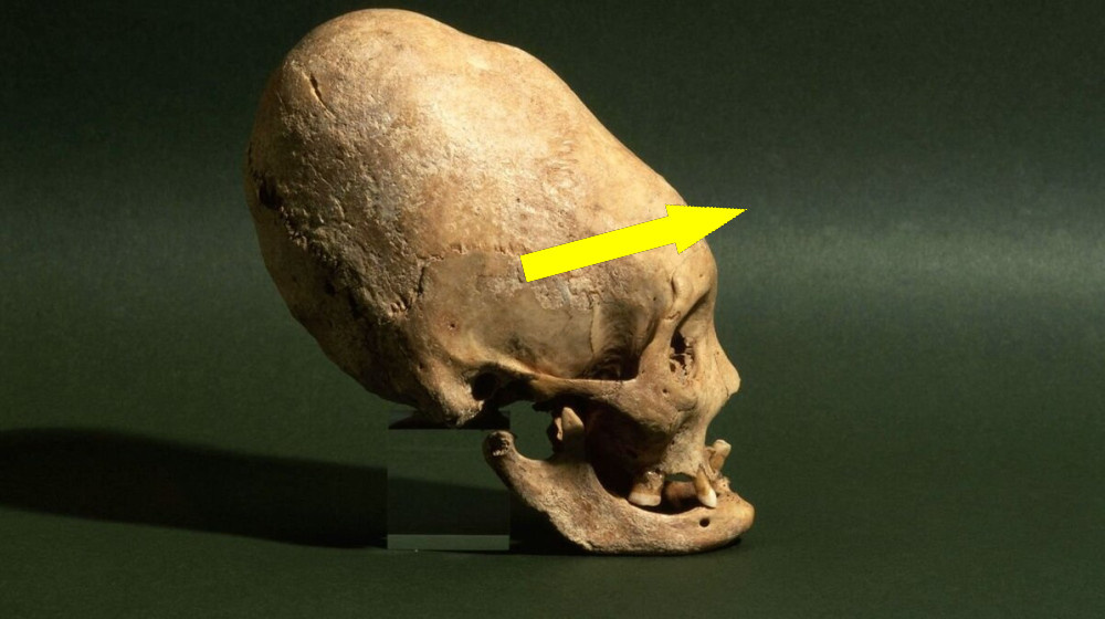    Тайна вытянутых черепов Паракаса скрывает лик неизвестной расы