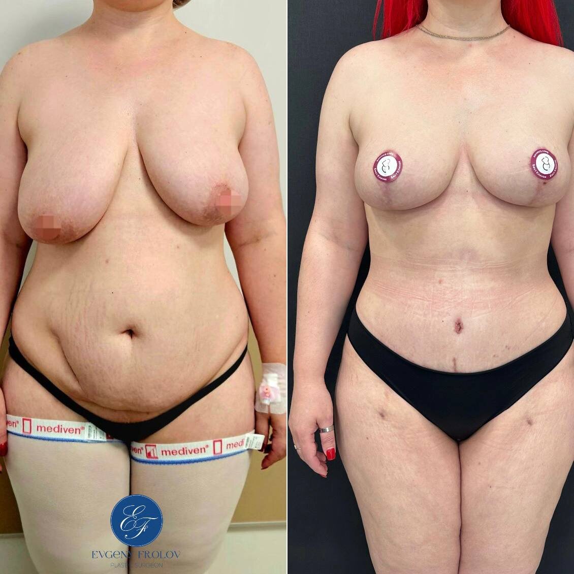 Работа пластического хирурга Фролова Е. В.