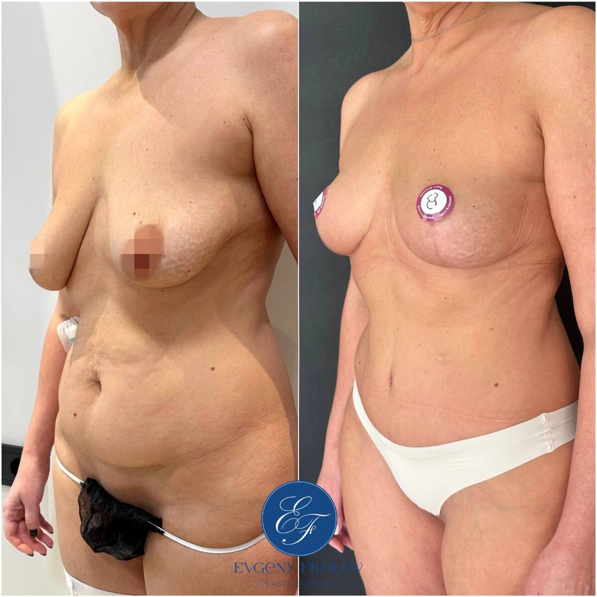 Работа пластического хирурга Фролова Е. В