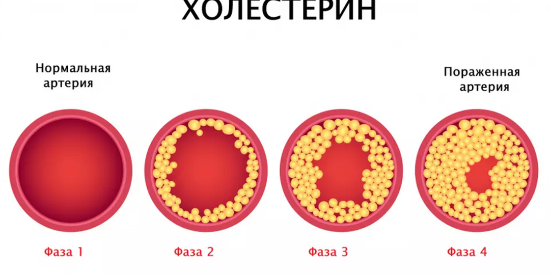 Холестерин После 60: Враг или Необходимая Защита? Разбор Популярных Мифов