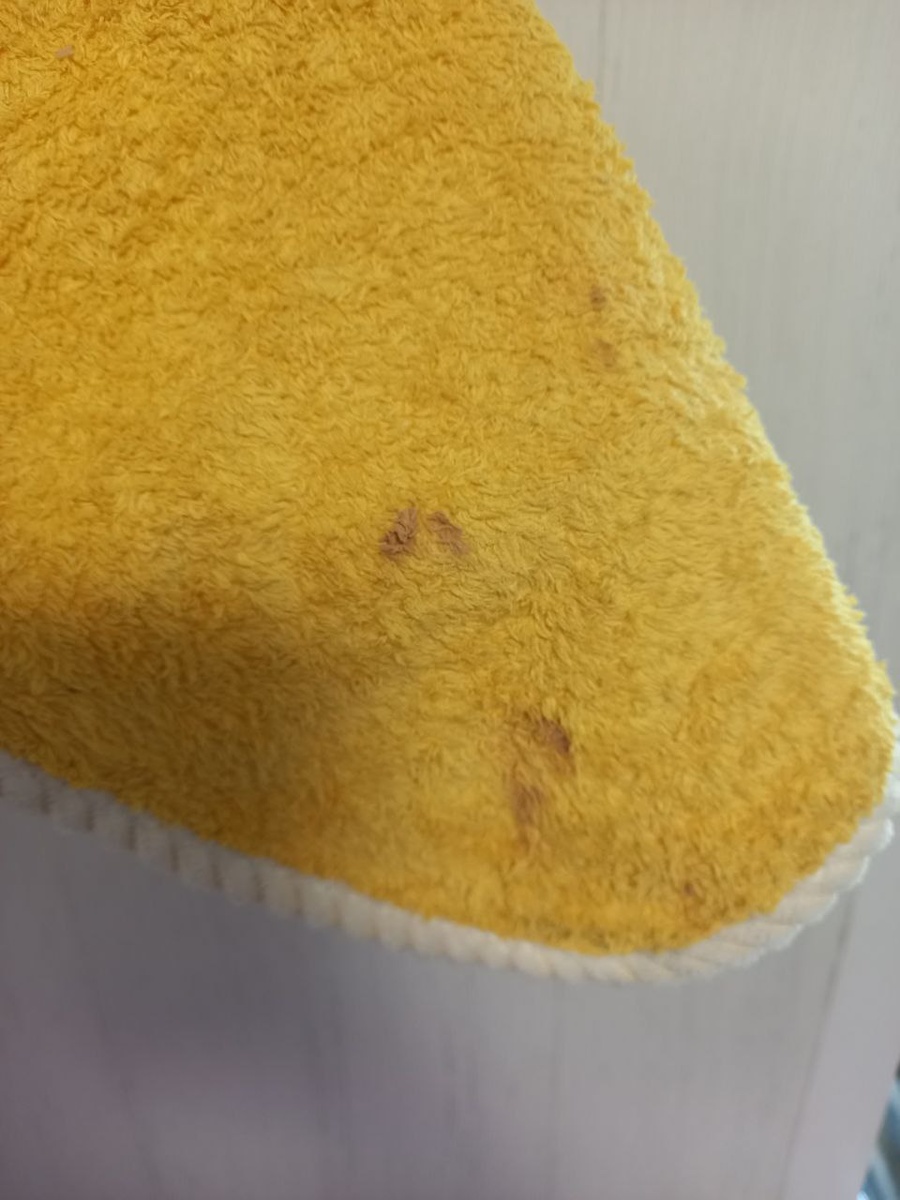 Пятна от тотального крема выглядят жирными