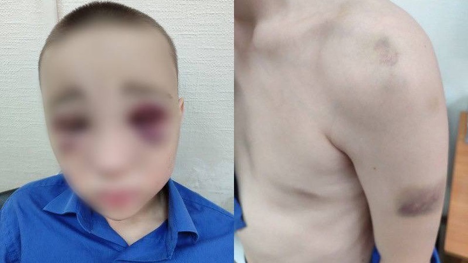 «Его три дня били палкой по голове»: под Новосибирском судят руководителя патриотического клуба, обвиняемого в избиении школьника