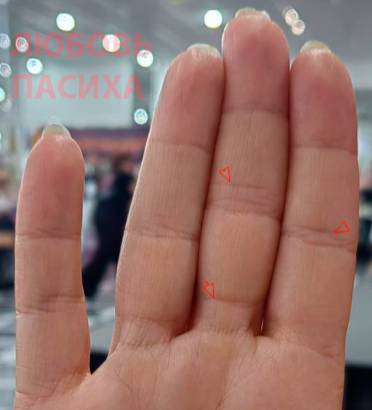 Линии Отчаяния и препятсвий