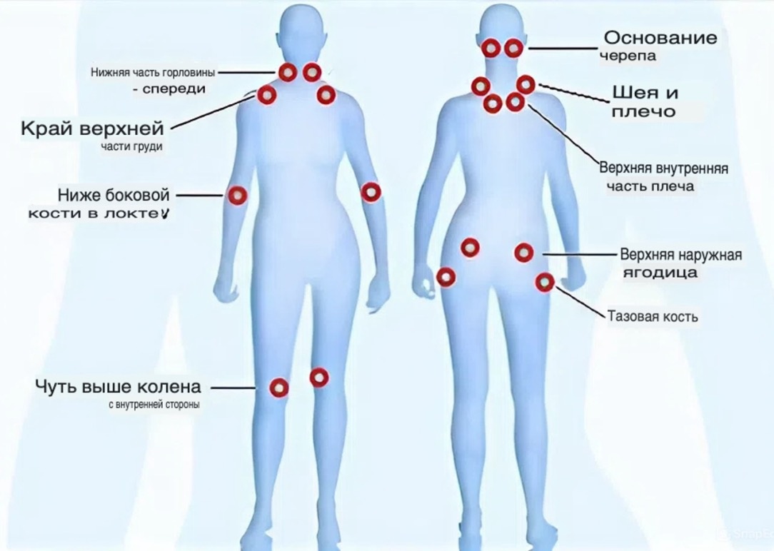 Хроническая боль. Триггерные точки