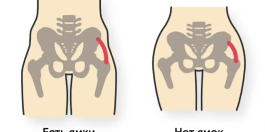 Ямки на ягодицах: дефект мышцы или зажим? Как проверить и исправить