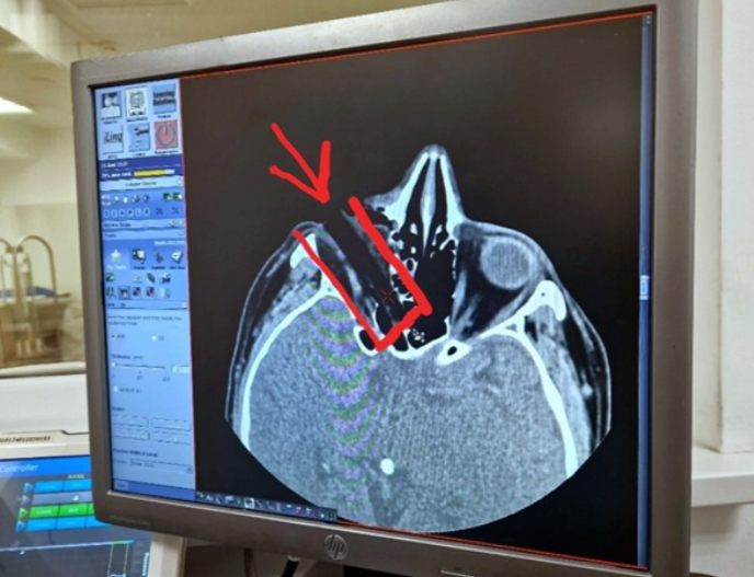     Управление здравоохранения по г.Набережные Челны