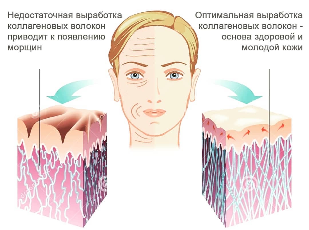 Аппаратные методики стимулируют выработку коллагена и эластина 