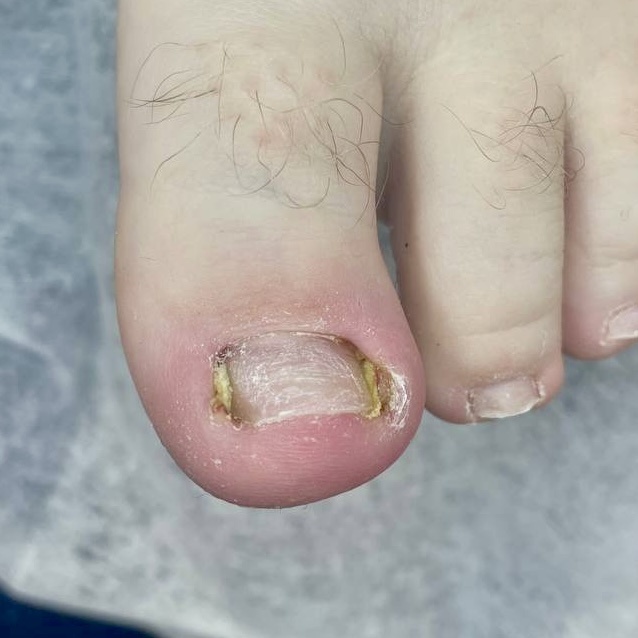 Автор фото - подолог Яна Варлет